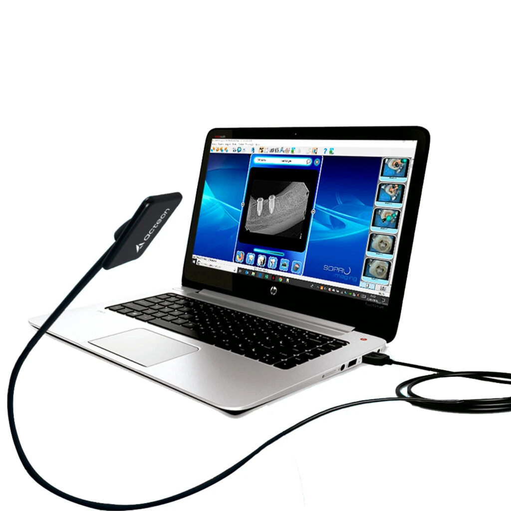 Radiografia digital odontológica exibida em notebook com sensor conectado
